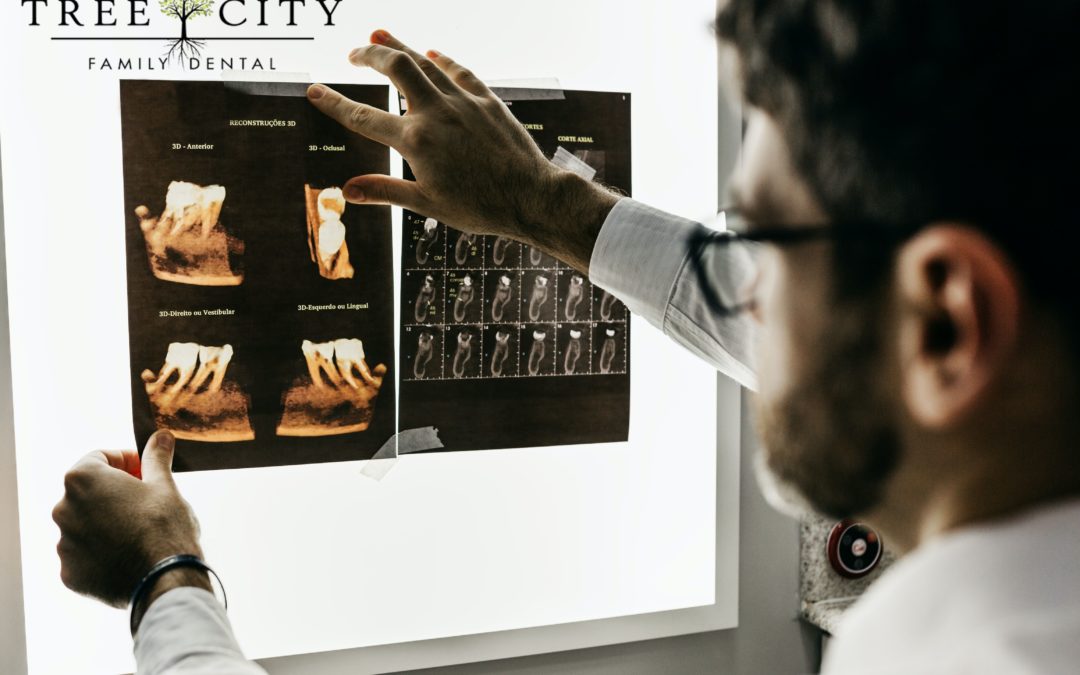 A dentist places dental x-rays onto a lit screen for viewing.