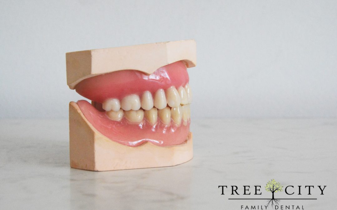 Model of a mouth sitting on a white countertop